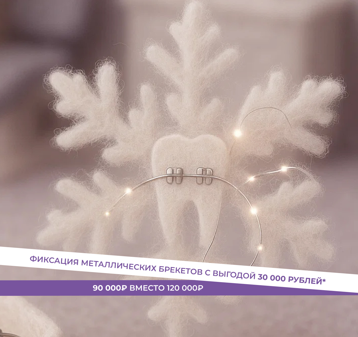 Фиксация металлических брекетов за 90 000 ₽ вместо 120 000 ₽!