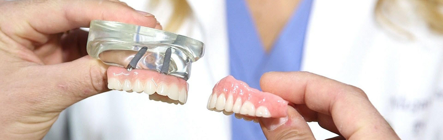 Как выбрать между съемными и несъемными протезами: полное руководство