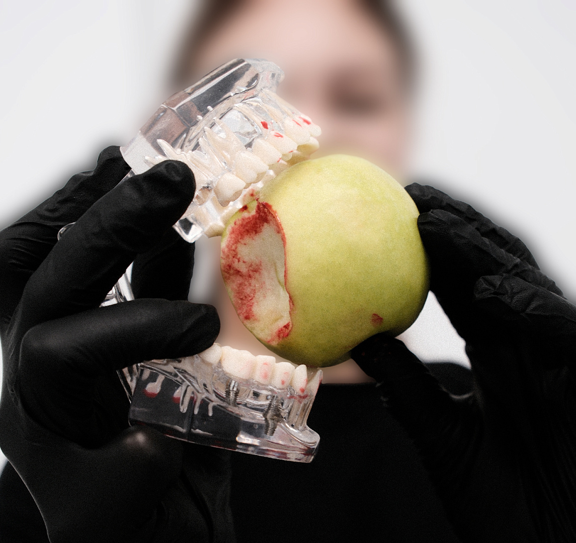 Консультация пародонтолога: раннее выявление заболеваний десен