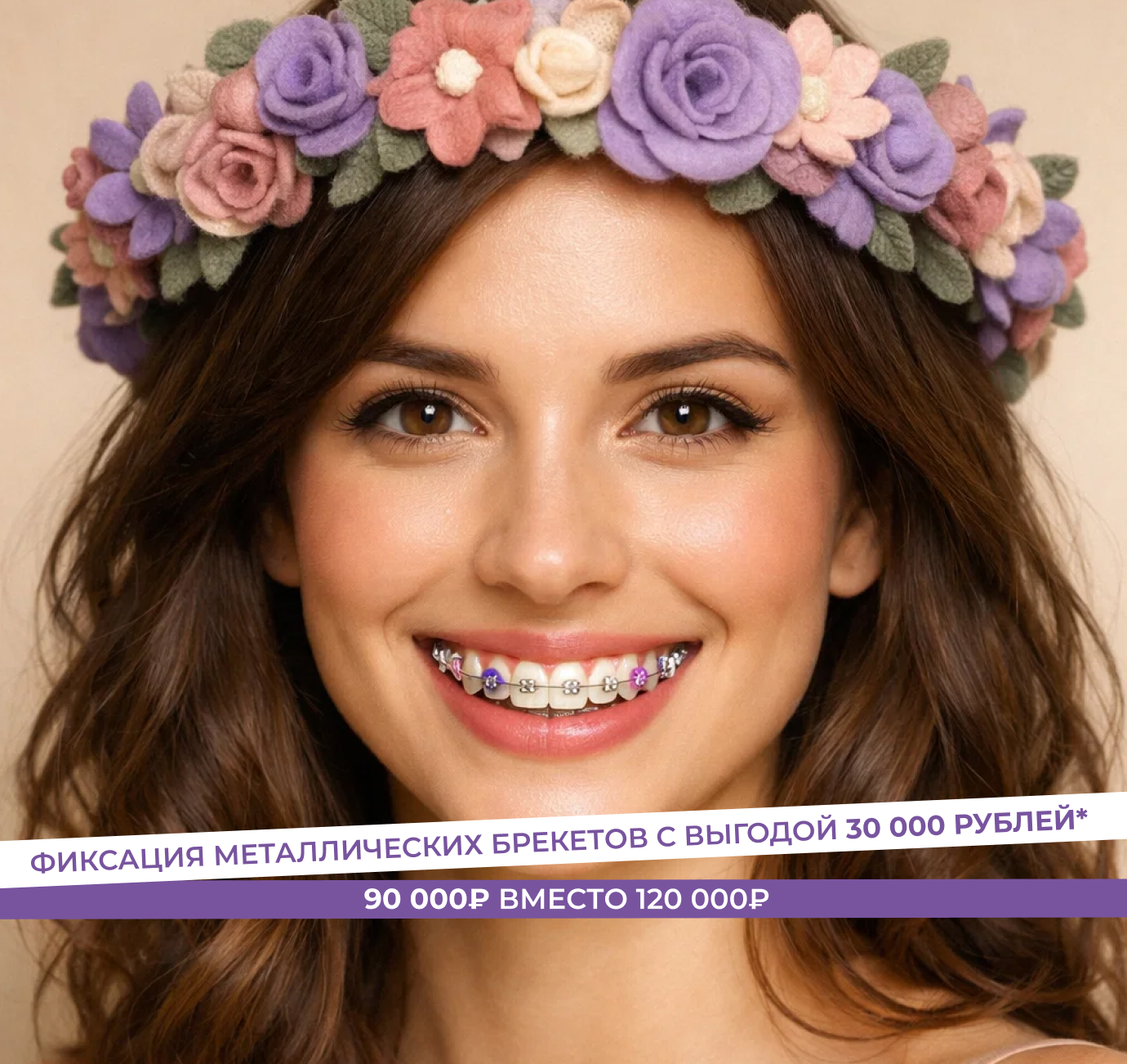 Фиксация металлических брекетов за 90 000 ₽ вместо 120 000 ₽!