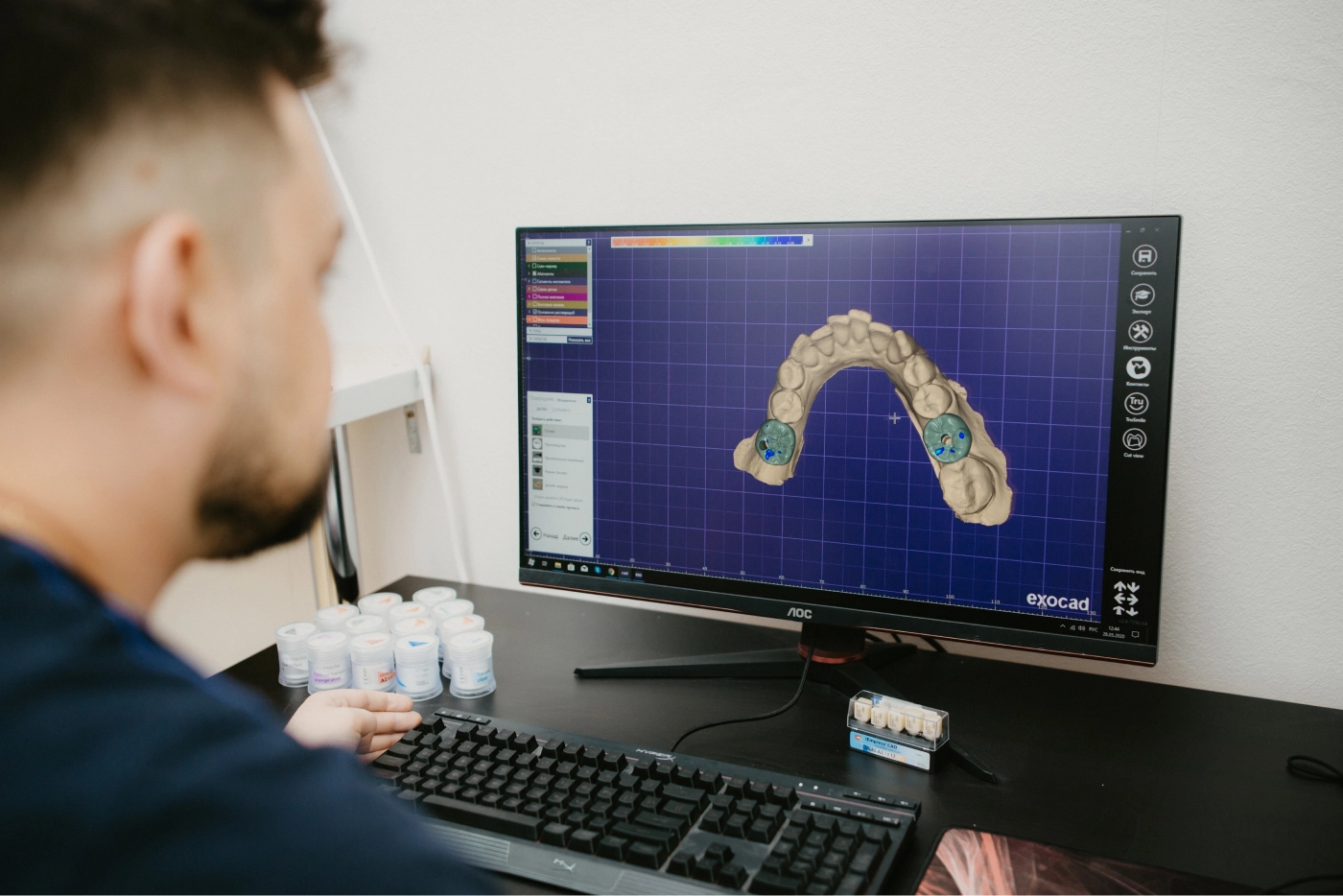 3D моделирование и 3D печать в стоматологии