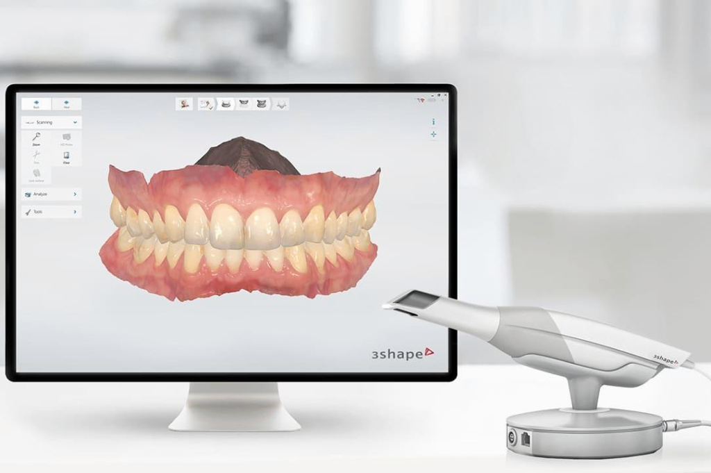 Итраоральные сканеры