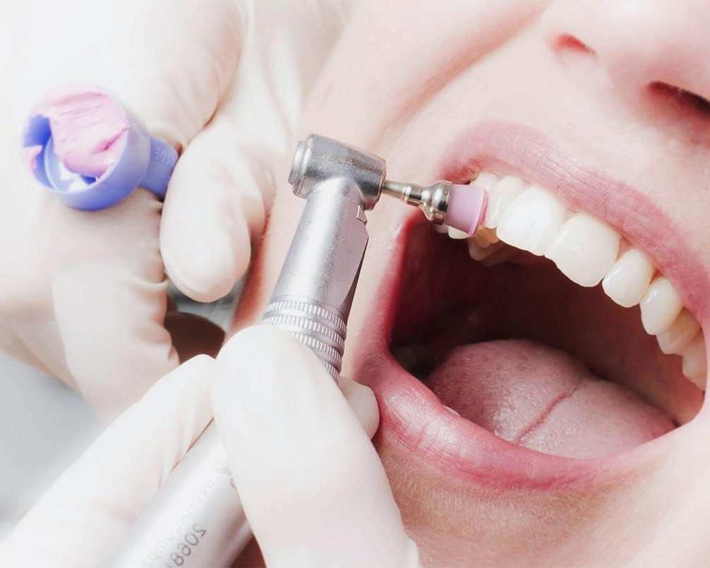 Гигиена после имплантации зубов