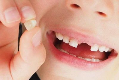 Можно ли не лечить молочные зубы?