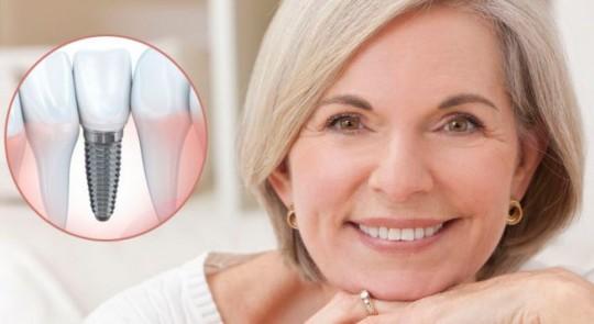 Несъемные протезы